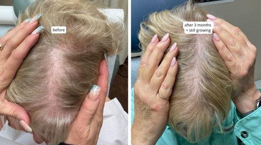 Real Hair Growth Results: What to Expect After 30,60 & 90 Days