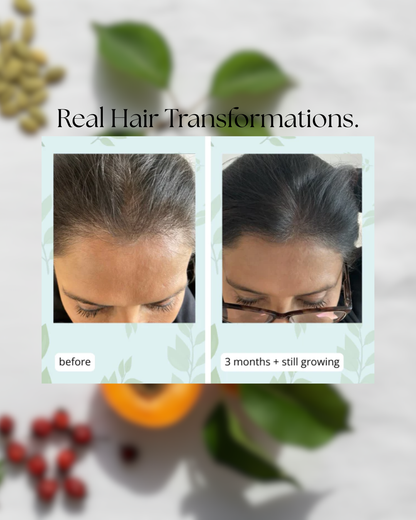 Hair Growth + Skin Support Supplement | MilVidas™