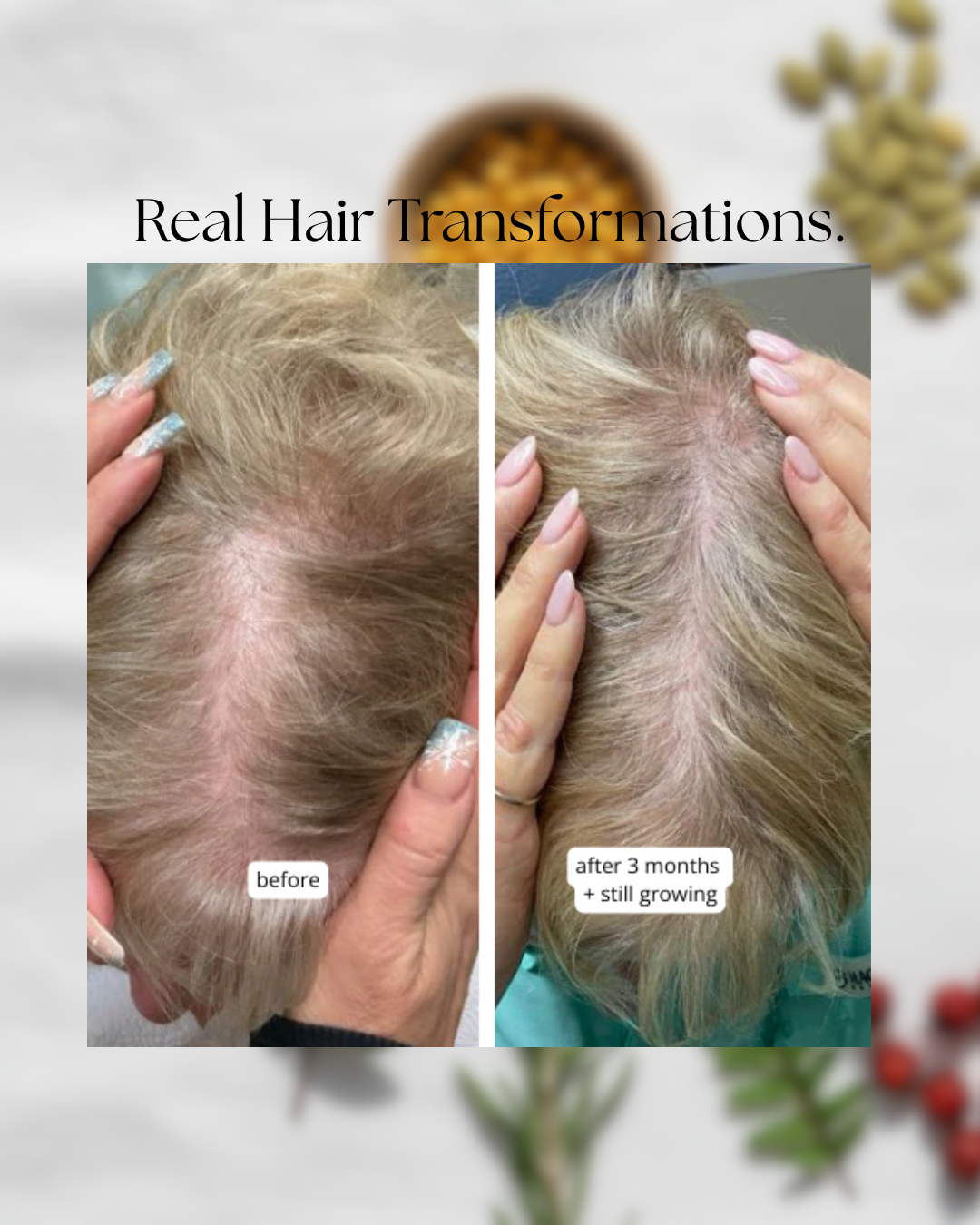 MilVidas™ Hair Growth + Skin Support Supplement