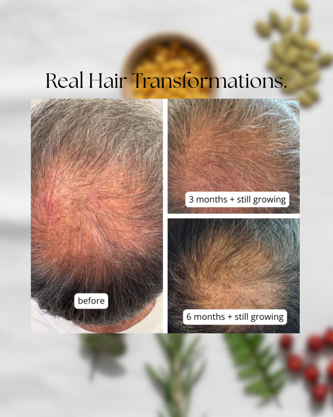 MilVidas™ Hair Growth + Skin Support Supplement