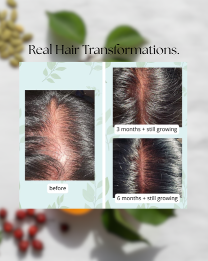 Hair Growth + Skin Support Supplement | MilVidas™