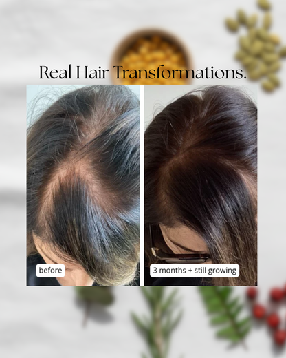 Hair Growth + Skin Support Supplement | MilVidas™