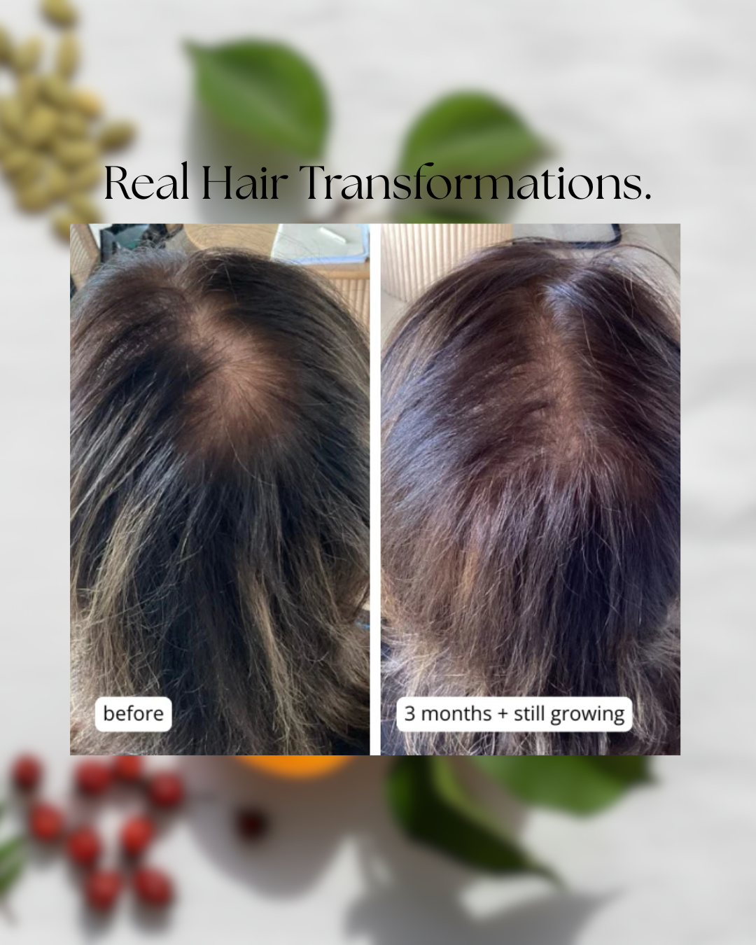 MilVidas™ Hair Growth + Skin Support Supplement