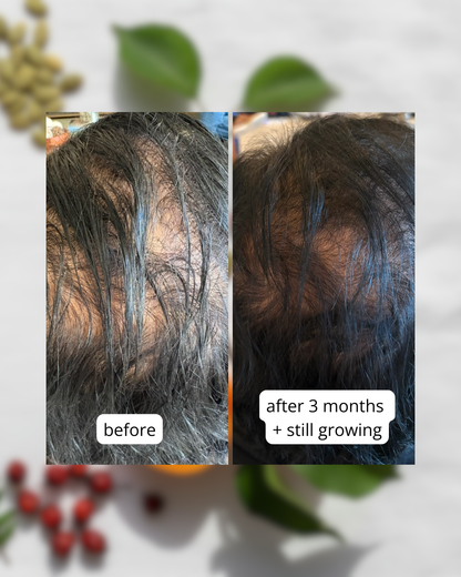 Hair Growth + Skin Support Supplement | MilVidas™