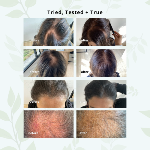 MilVidas™ Hair Growth + Skin Support Supplement